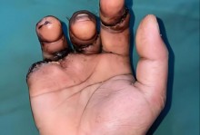 突发！武切维奇仅107秒右手无名指骨折 绿军全明星中锋伤退